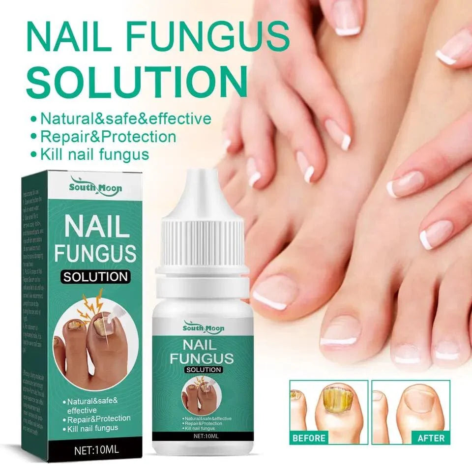 FAST NAIL FUNGUS TREATMENTS | NAIL REPAIR ESSENCES SERUM