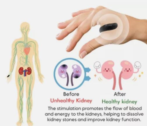 SUGAR CONTROL LI4 ACUPRESSURE POINT CLIP MAGNETIC