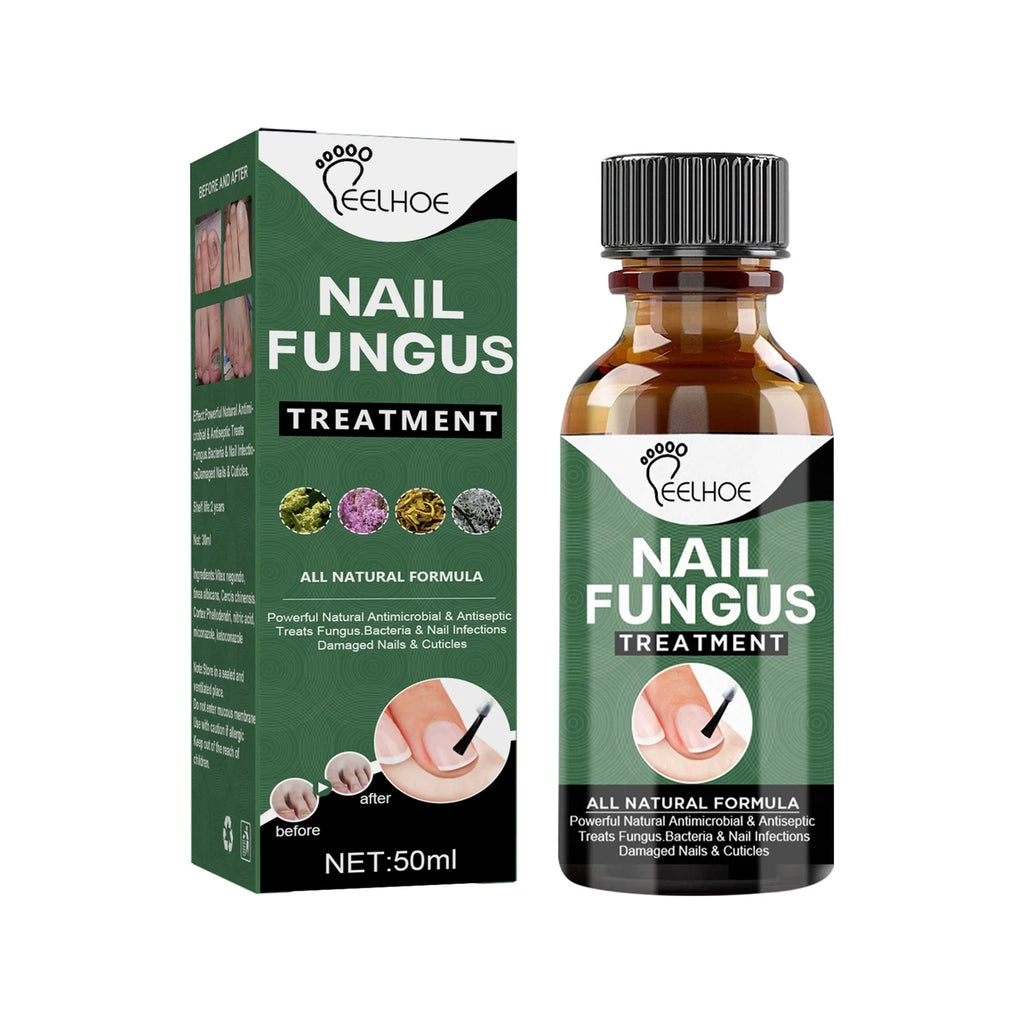 FAST NAIL FUNGUS TREATMENTS NAIL REPAIR ESSENCES SERUM