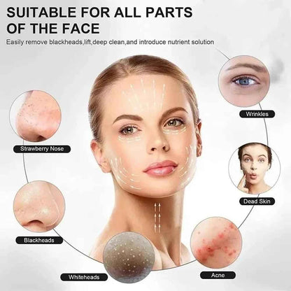 BLACKHEAD REMOVAL SKIN TOOL