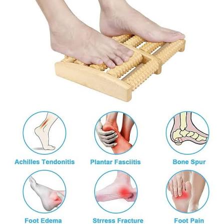 PRODESIRE™ WOODEN FOOT MASSAGER ROLLER
